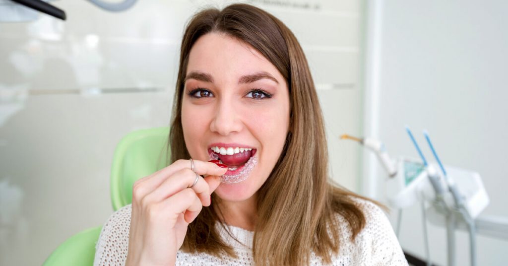 How to Choose the Best Dental Aligners Specialist Garagistes